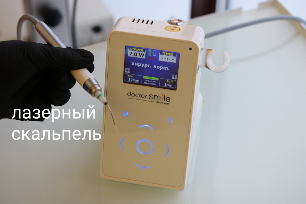 Имплантация искусственных зубов по технологии All-on-4 имплантация зубов all-on-4